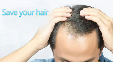 Revitalize Your Hairline: The Benefits of Hair Transplantation